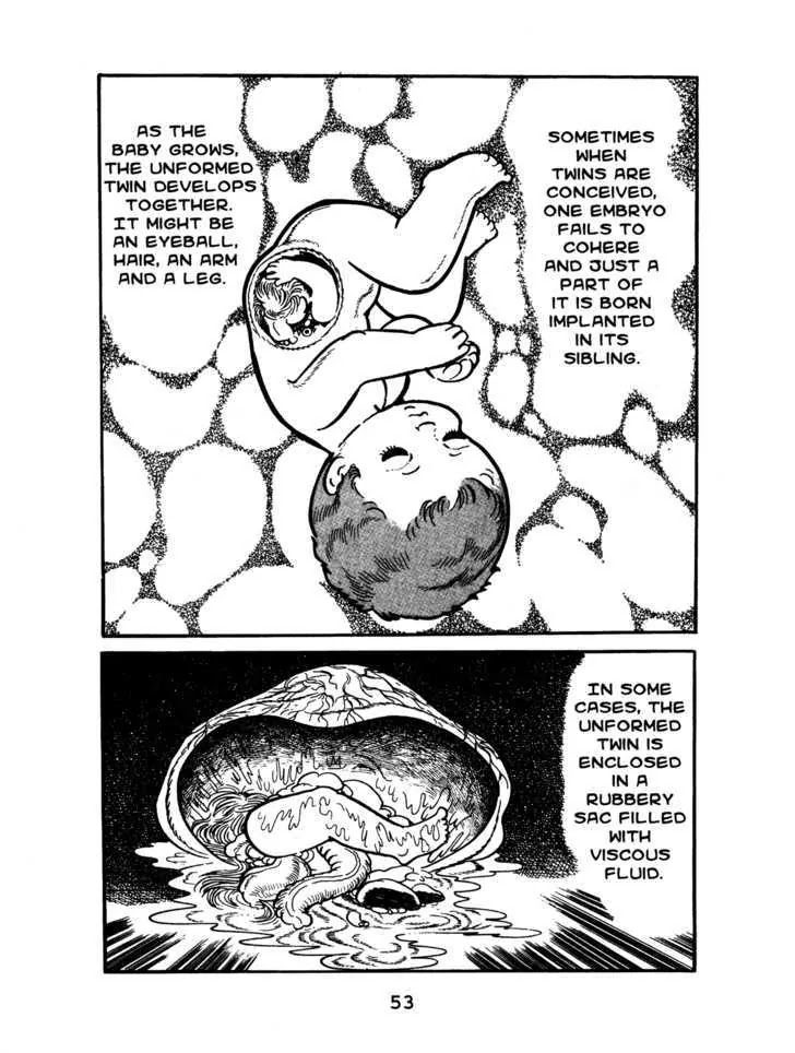 Black Jack Chapter 1.3 page 5 - Vol.1 Chapter 3: Teratoid Cystoma