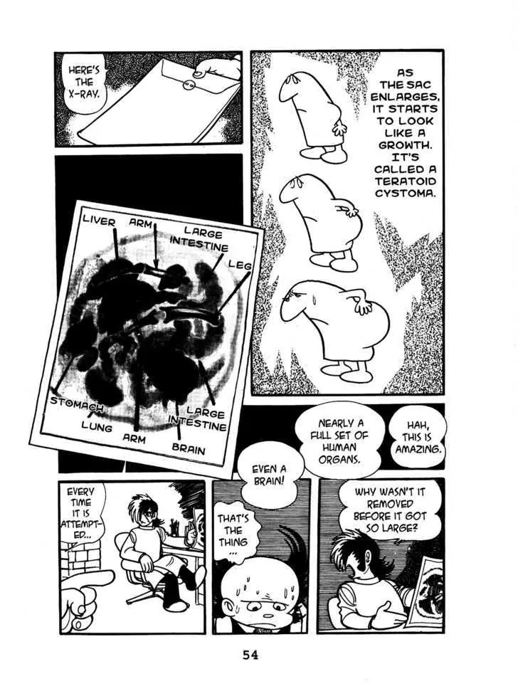 Black Jack Chapter 1.3 page 6 - Vol.1 Chapter 3: Teratoid Cystoma