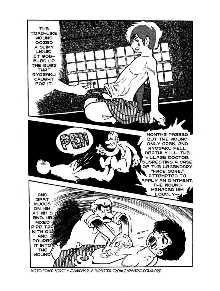 Black Jack Chapter 1.4 page 3 - Vol.1 Chapter 4: The Face Sore