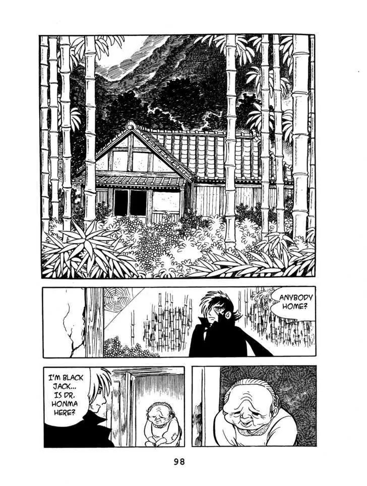 Black Jack Chapter 1.5 page 6 - Vol.1 Chapter 5: Sometimes like Pearls