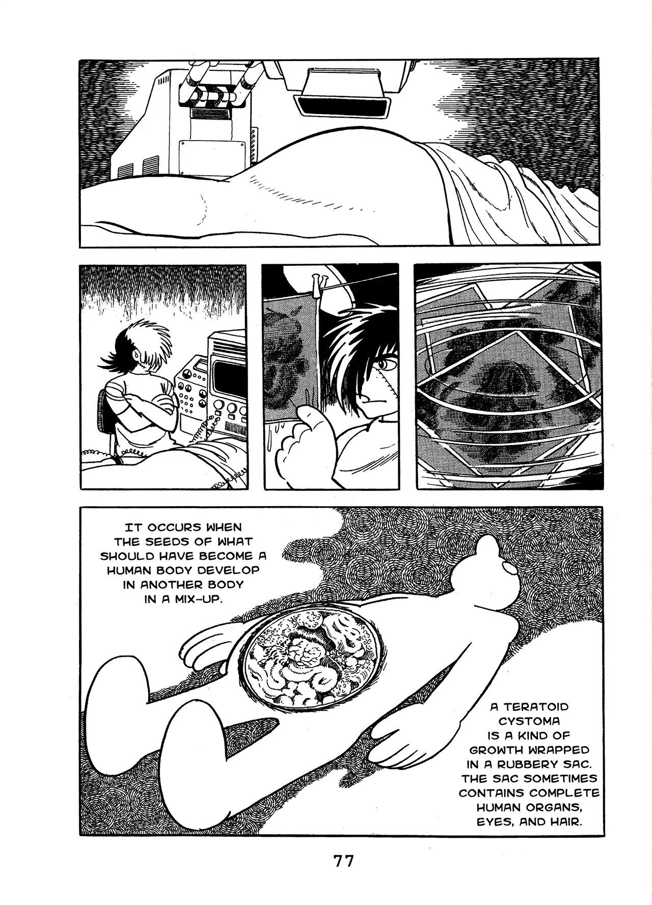 Black Jack Chapter 13.4 page 9 - Vol.13 Chapter 4: Teratoid Cystoma, Part 2