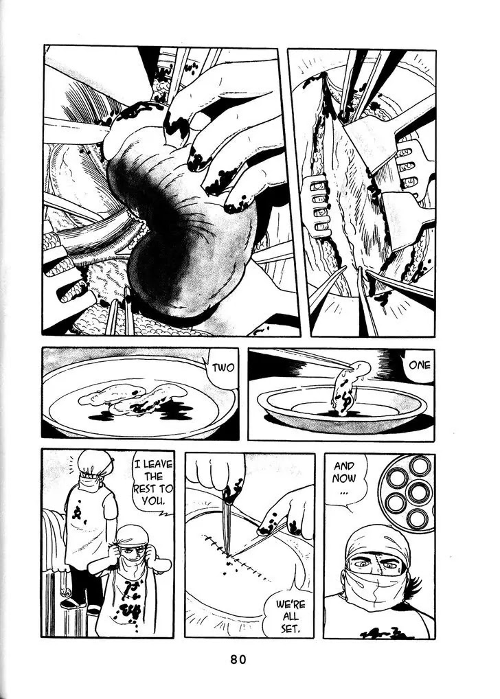 Black Jack Chapter 14.4 page 14 - Vol.14 Chapter 4: Full-Moon Disease