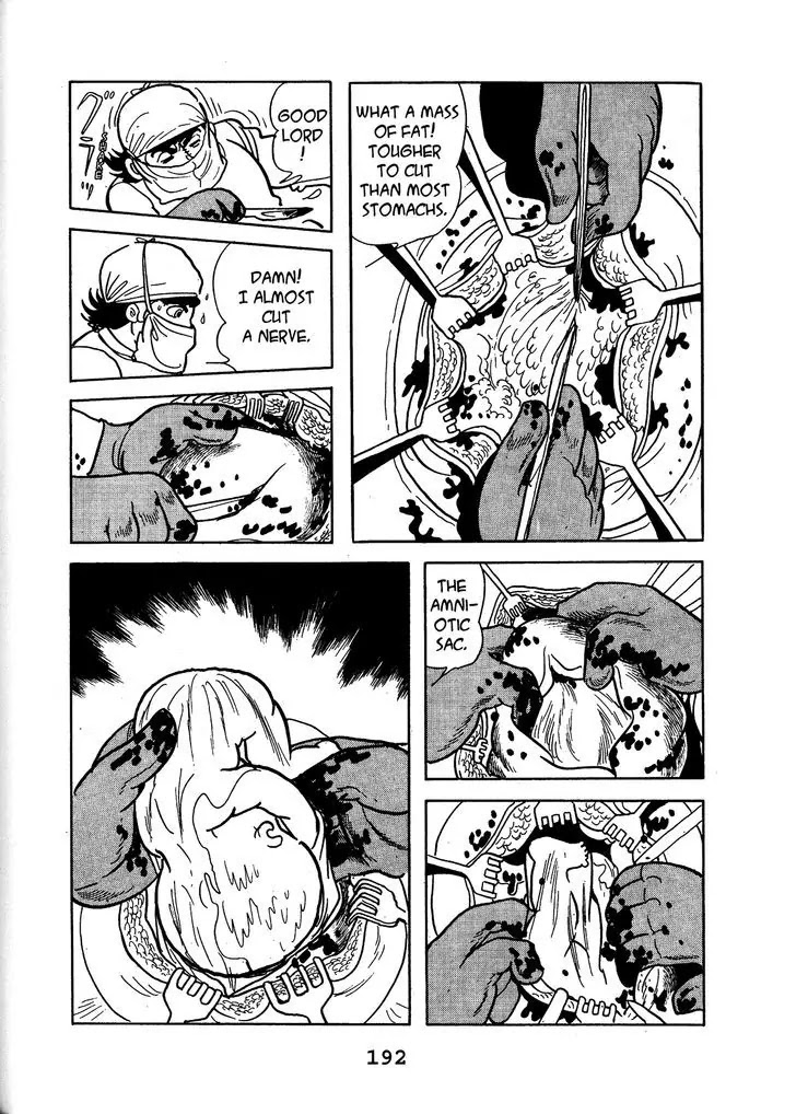 Black Jack Chapter 14.9 page 17 - Vol.14 Chapter 9: A Rapid Current