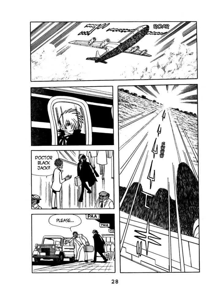 Black Jack Chapter 3.2 page 2 - Vol.3 Chapter 2: Shrinking