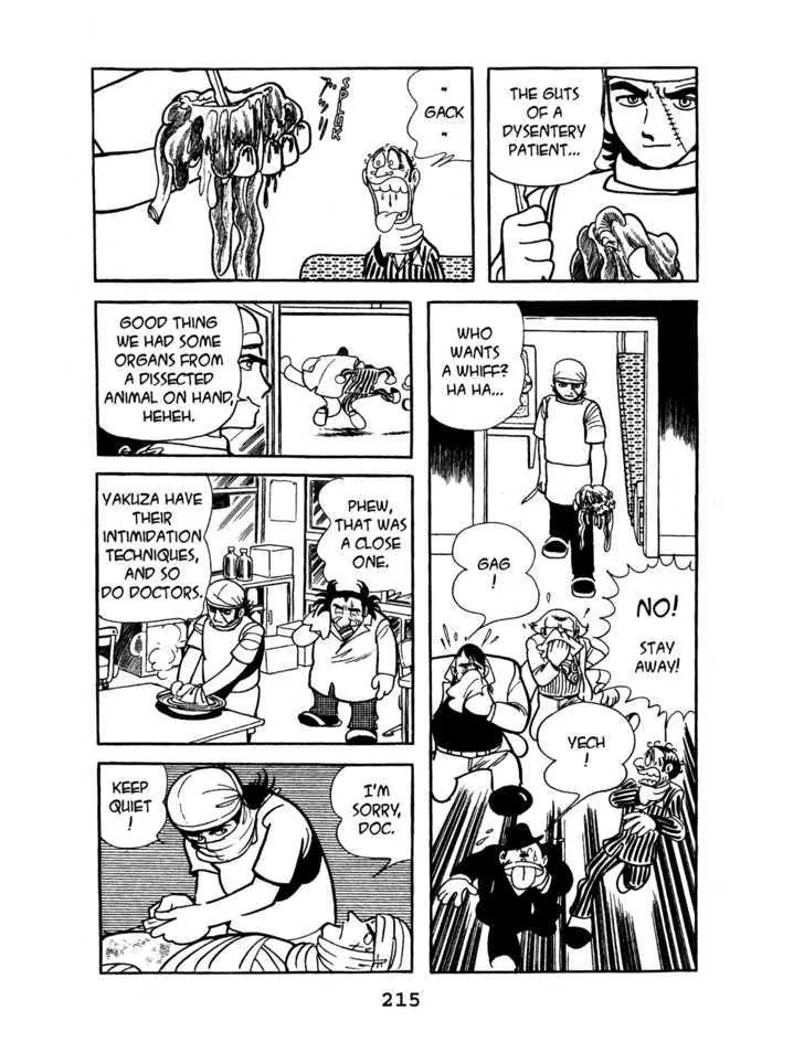 Black Jack Chapter 4.10 page 11 - Vol.4 Chapter 10: Burned Doll