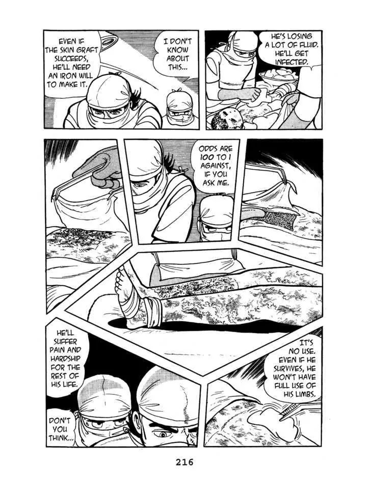 Black Jack Chapter 4.10 page 12 - Vol.4 Chapter 10: Burned Doll