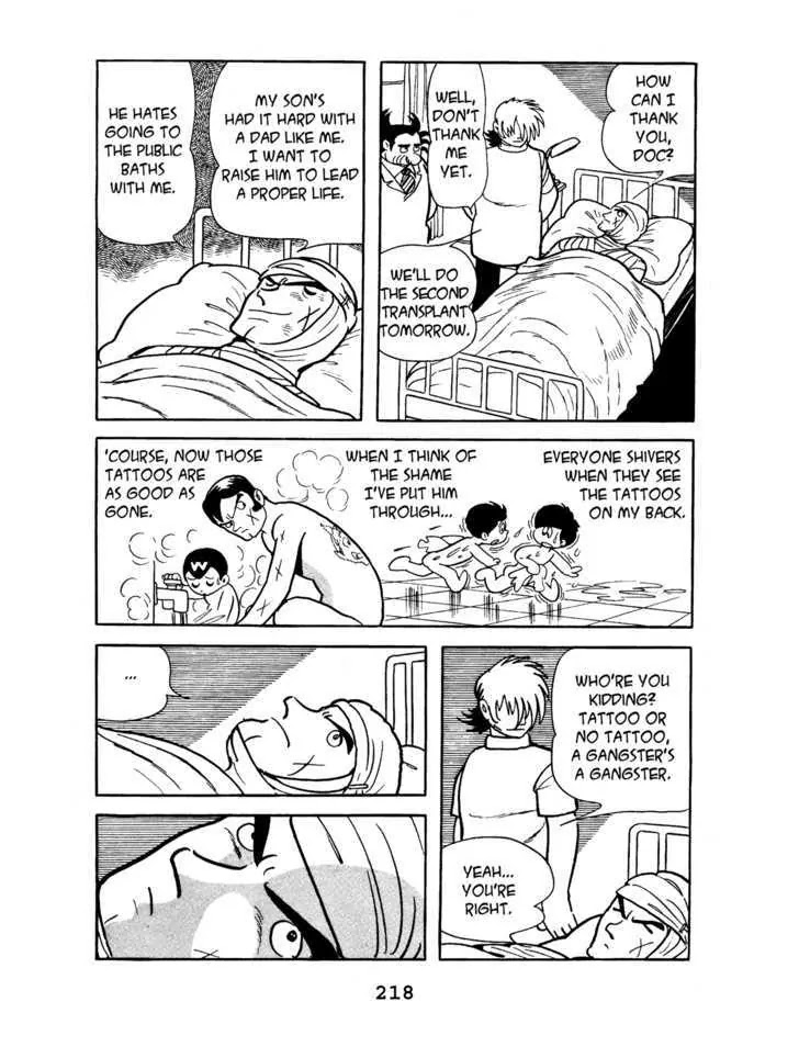 Black Jack Chapter 4.10 page 14 - Vol.4 Chapter 10: Burned Doll
