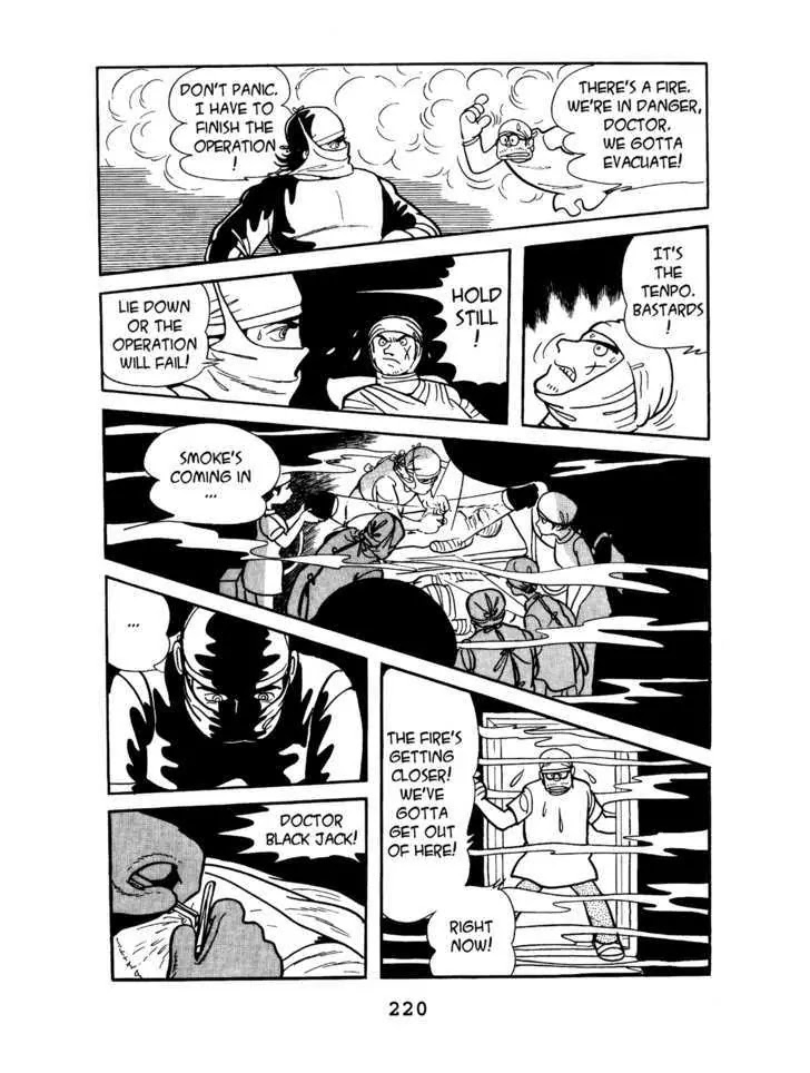 Black Jack Chapter 4.10 page 16 - Vol.4 Chapter 10: Burned Doll