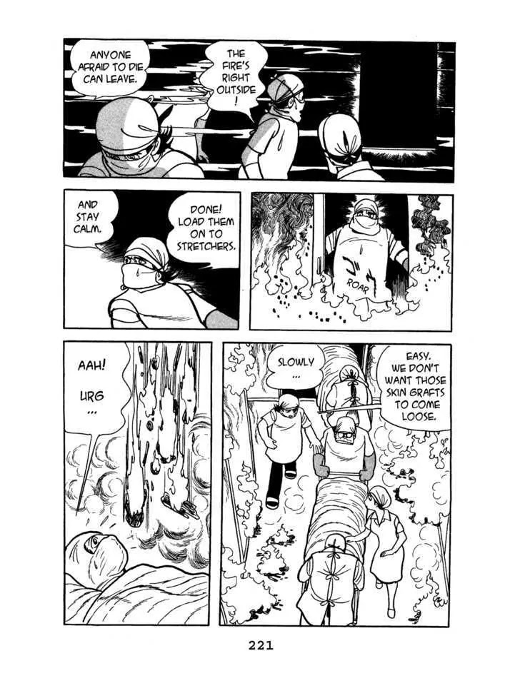 Black Jack Chapter 4.10 page 17 - Vol.4 Chapter 10: Burned Doll