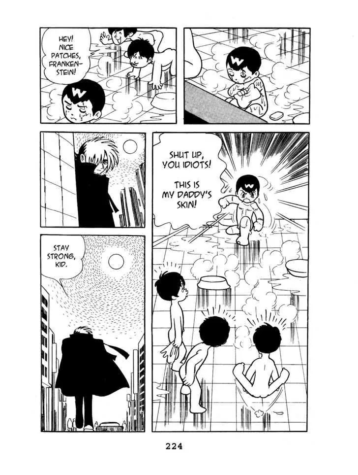 Black Jack Chapter 4.10 page 20 - Vol.4 Chapter 10: Burned Doll