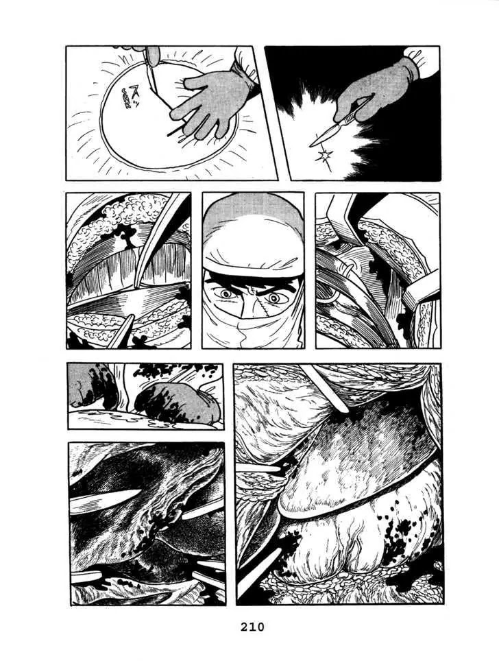 Black Jack Chapter 5.10 page 16 - Vol.5 Chapter 10: 99% Water