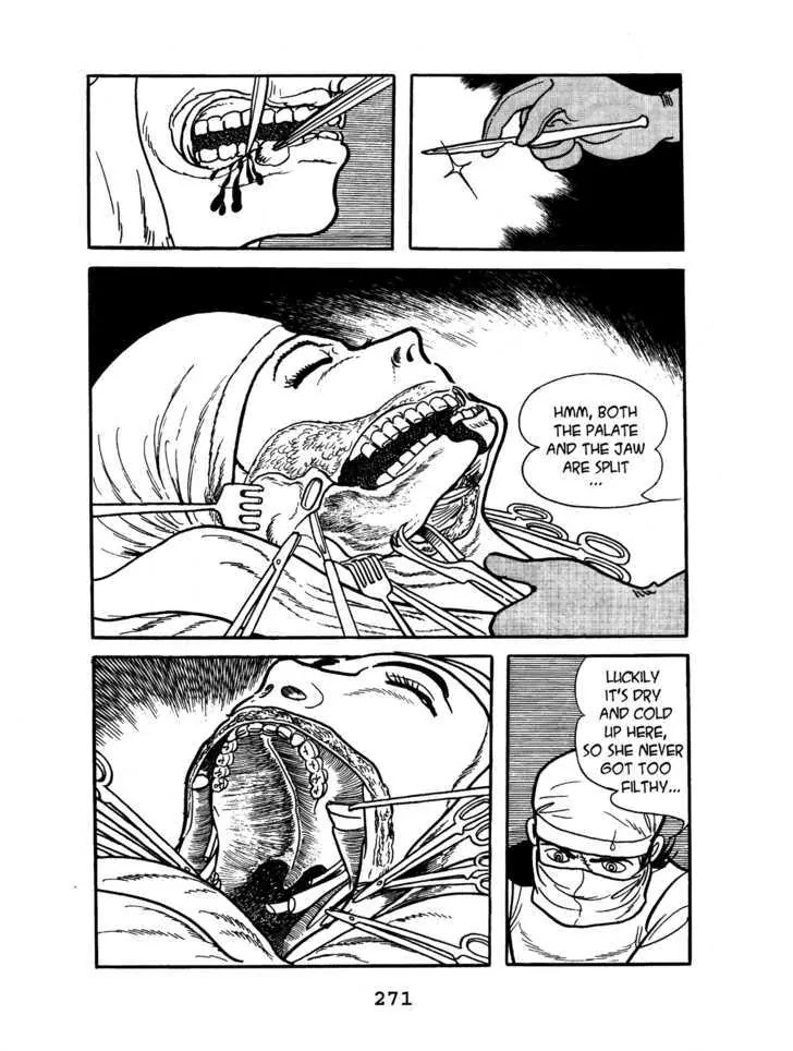 Black Jack Chapter 5.13 page 13 - Vol.5 Chapter 13: Wolf Girl