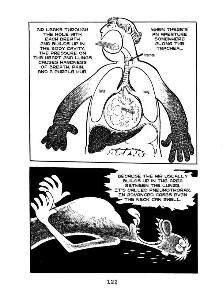 Black Jack Chapter 5.6 page 8 - Vol.5 Chapter 6: There was a Valve!