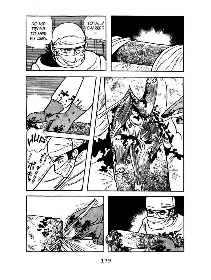Black Jack Chapter 6.8 page 11 - Vol.6 Chapter 8: Amidst Fire and Ashes
