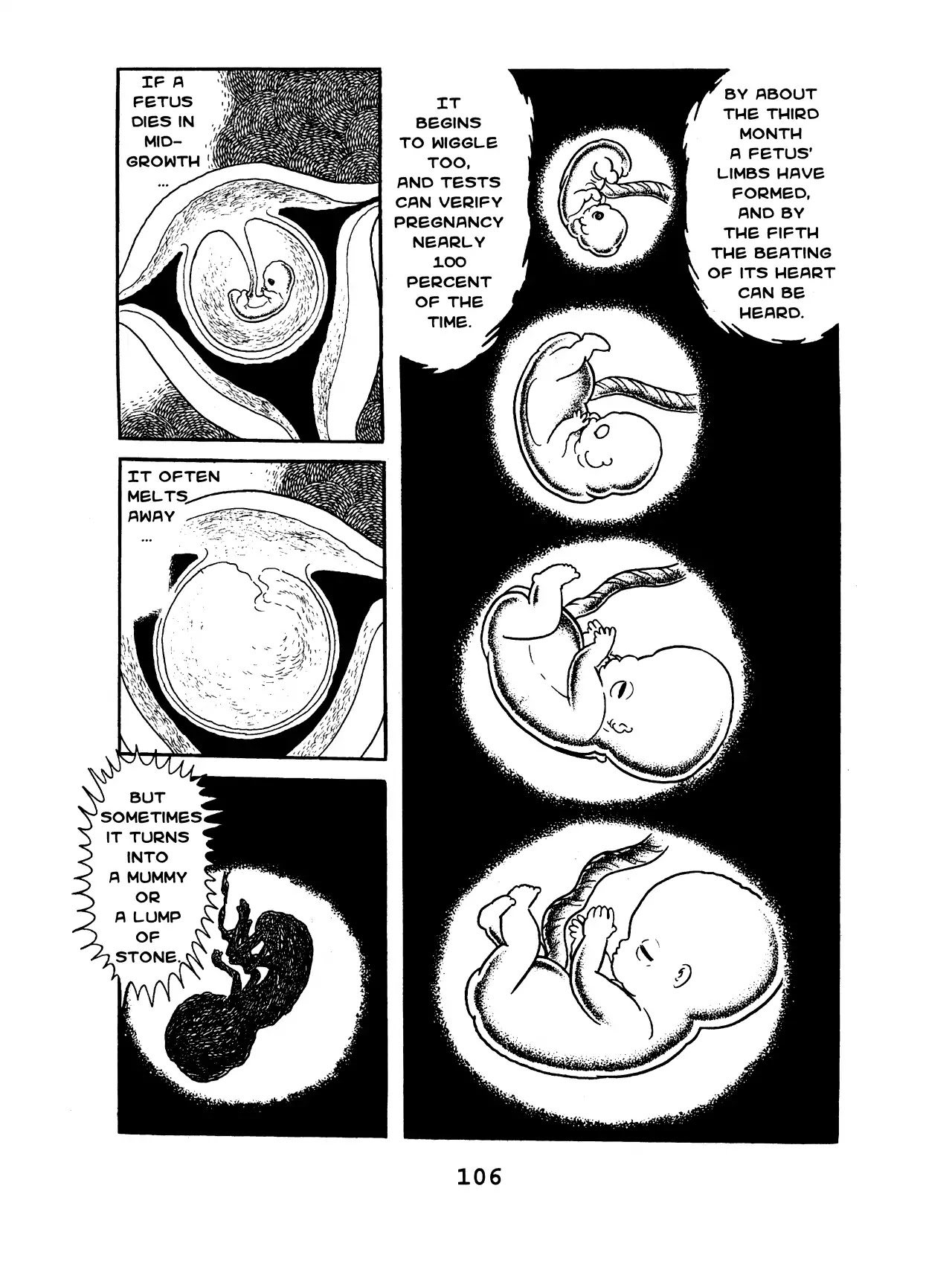 Black Jack Chapter 8.5 page 12 - Vol.8 Chapter 5: Abnormal Pregnancy