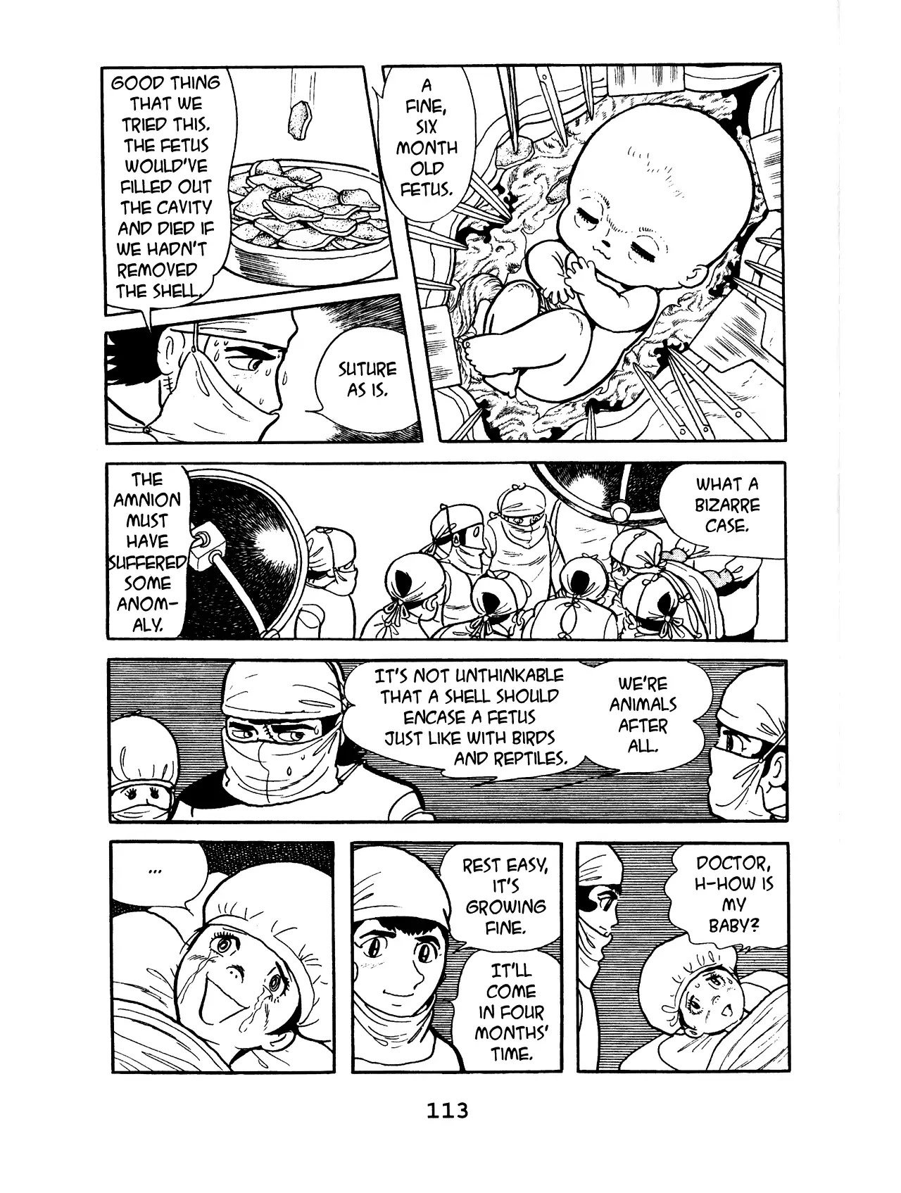 Black Jack Chapter 8.5 page 19 - Vol.8 Chapter 5: Abnormal Pregnancy