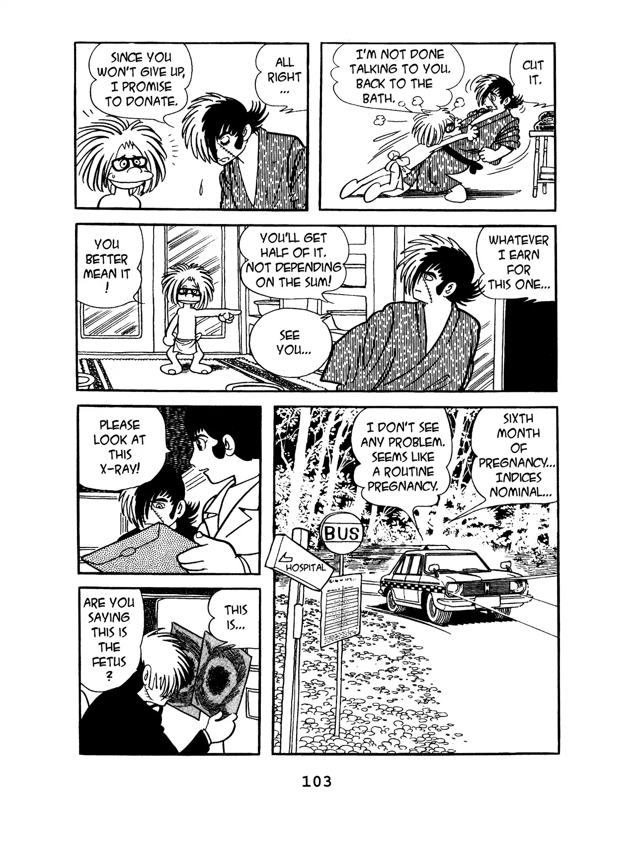 Black Jack Chapter 8.5 page 9 - Vol.8 Chapter 5: Abnormal Pregnancy