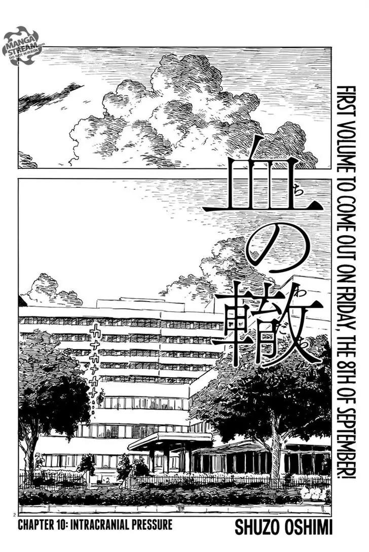 Chi no Wadachi Chapter 10 page 2 - Chapter 10: Intracranial Pressure