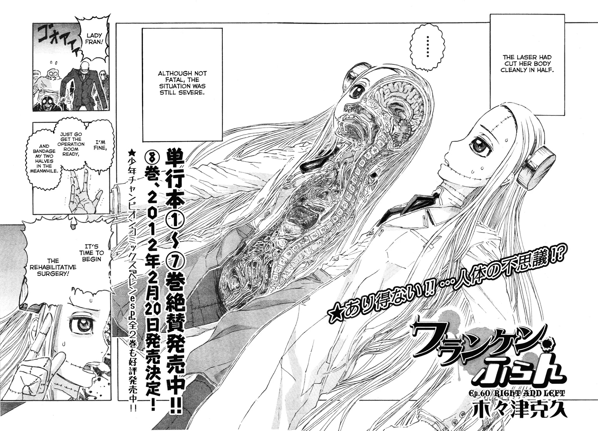 Franken Fran Chapter 60 page 2 - Chapter 60: Right And Left
