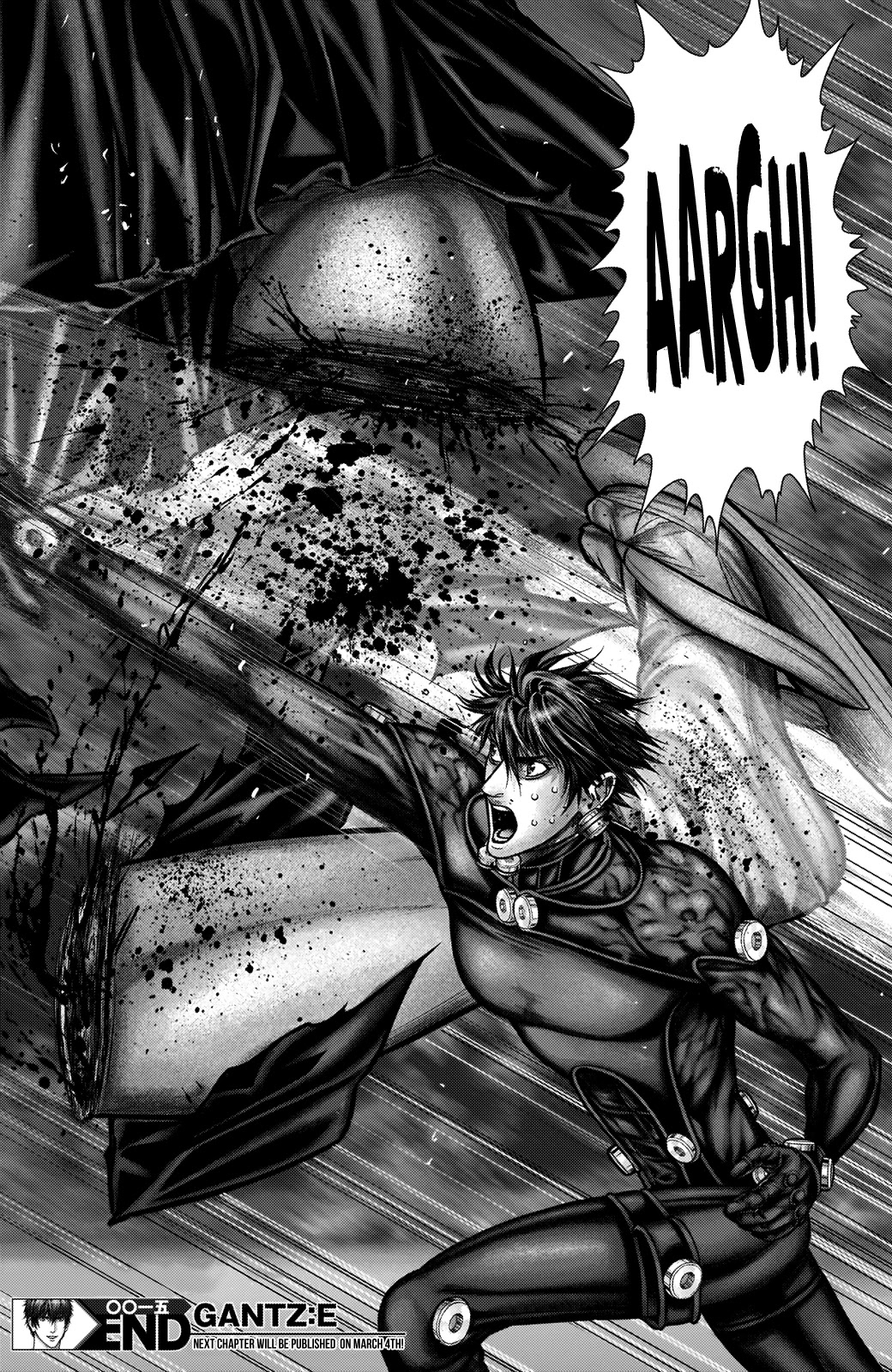 Gantz:E Chapter 15 page 18 - Chapter 15: Amputation