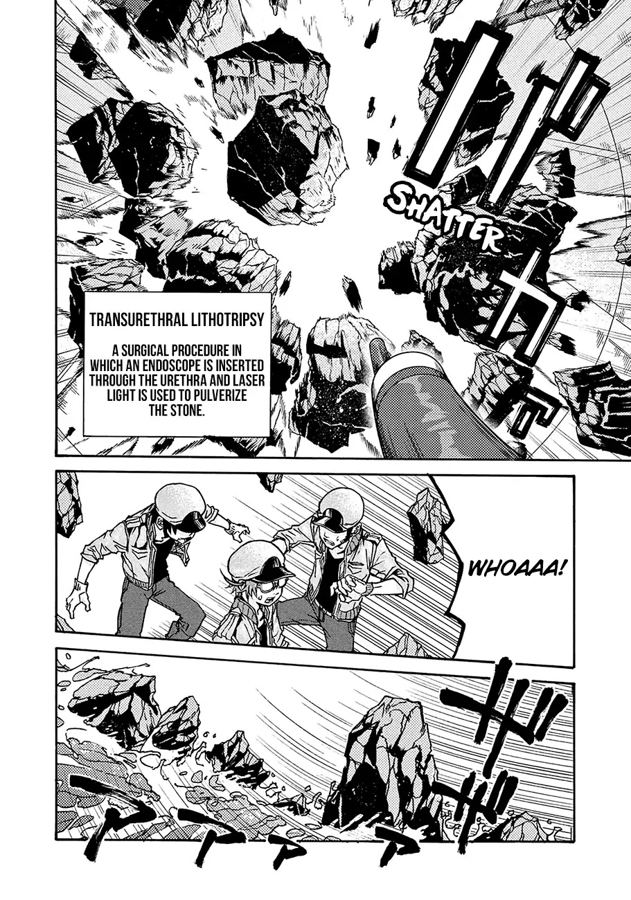 Hataraku Saibou BLACK Chapter 13 page 20 - Chapter 13: Kidney, Ureterolithiasis, Hematuria