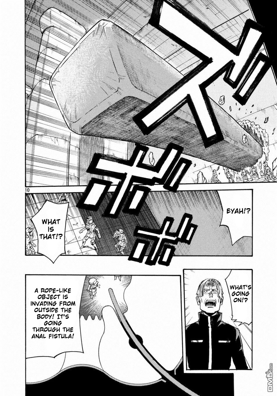 Hataraku Saibou BLACK Chapter 22 page 10 - Chapter 22: Anal Fistula, Liability, Credit