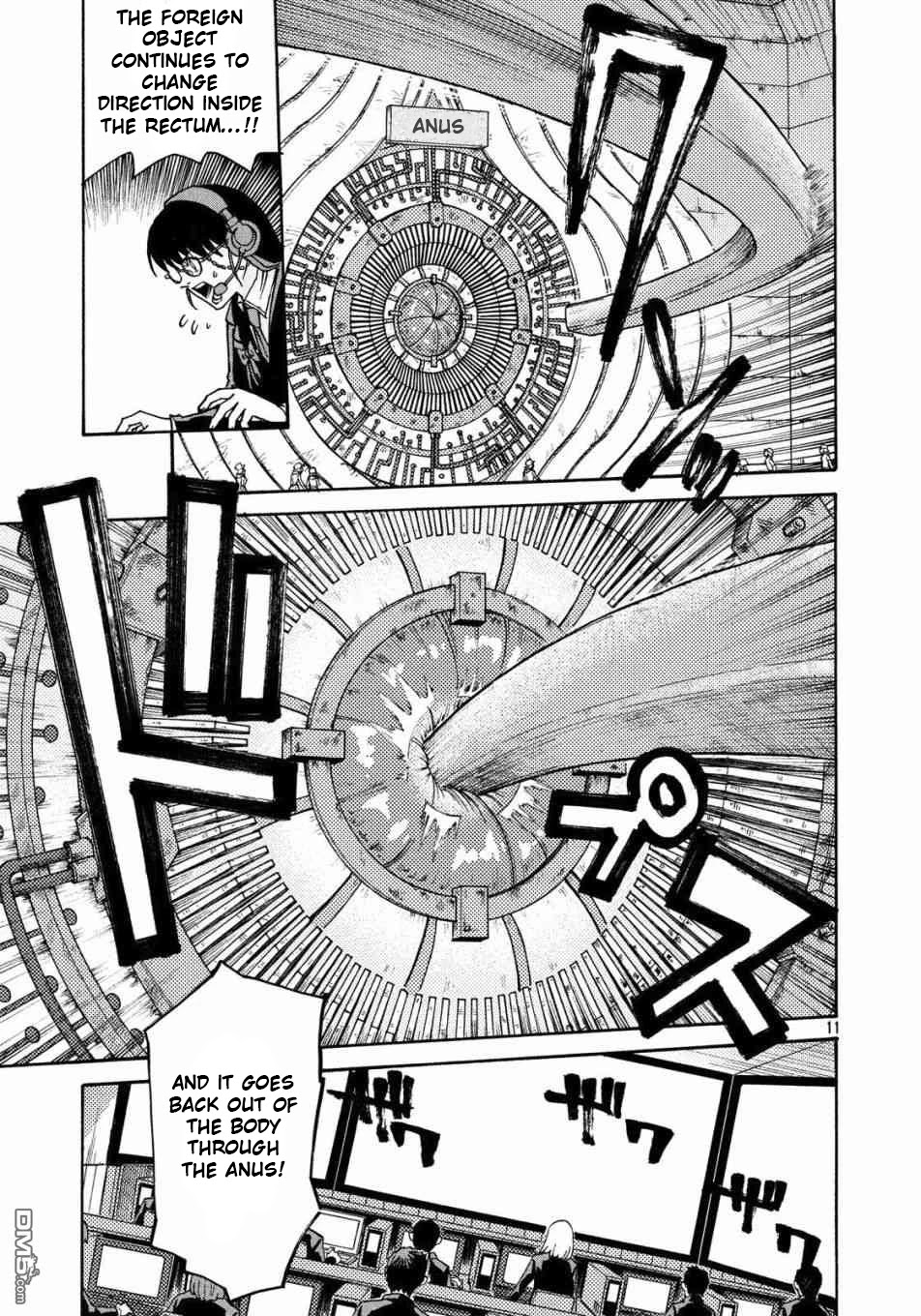 Hataraku Saibou BLACK Chapter 22 page 11 - Chapter 22: Anal Fistula, Liability, Credit