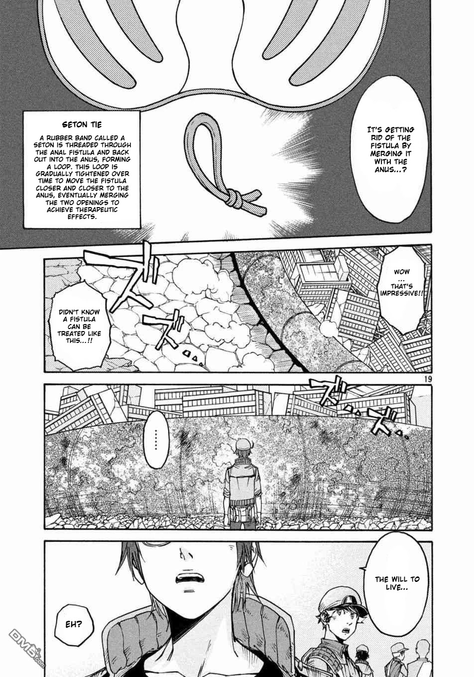 Hataraku Saibou BLACK Chapter 22 page 19 - Chapter 22: Anal Fistula, Liability, Credit