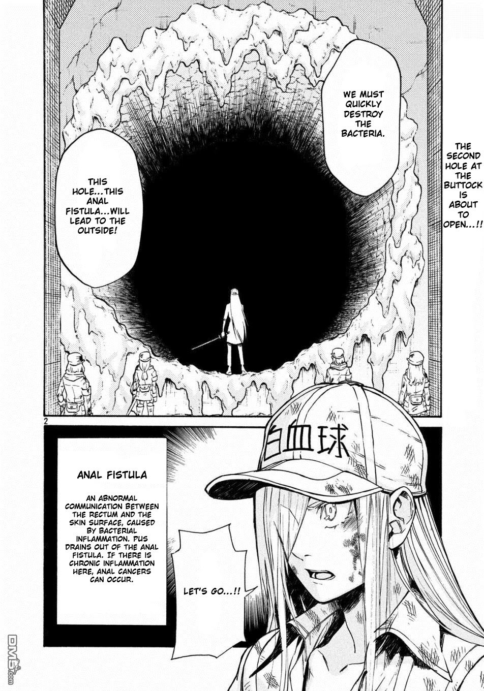 Hataraku Saibou BLACK Chapter 22 page 2 - Chapter 22: Anal Fistula, Liability, Credit