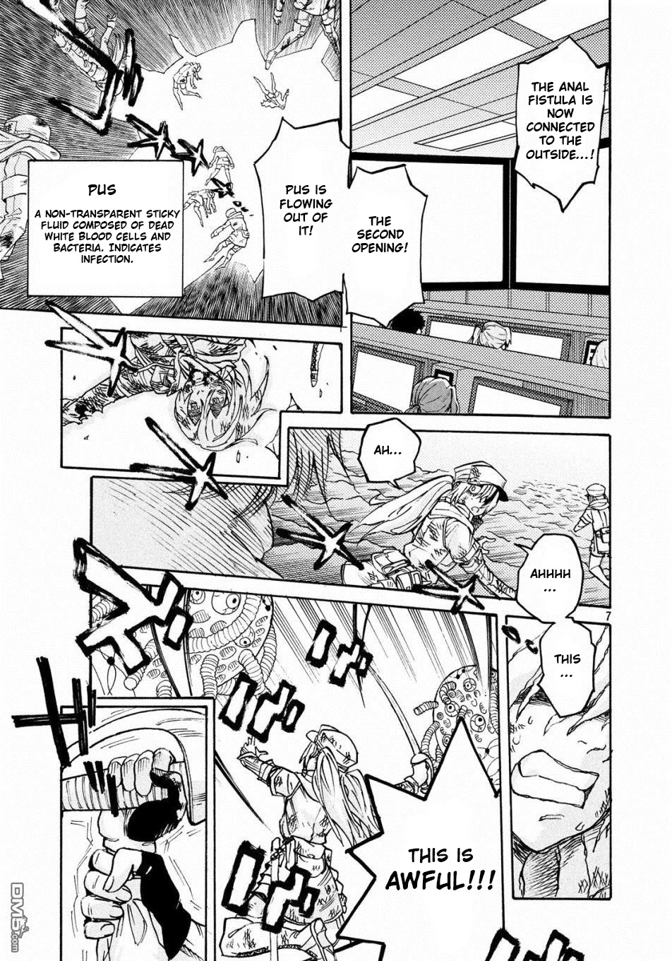 Hataraku Saibou BLACK Chapter 22 page 7 - Chapter 22: Anal Fistula, Liability, Credit
