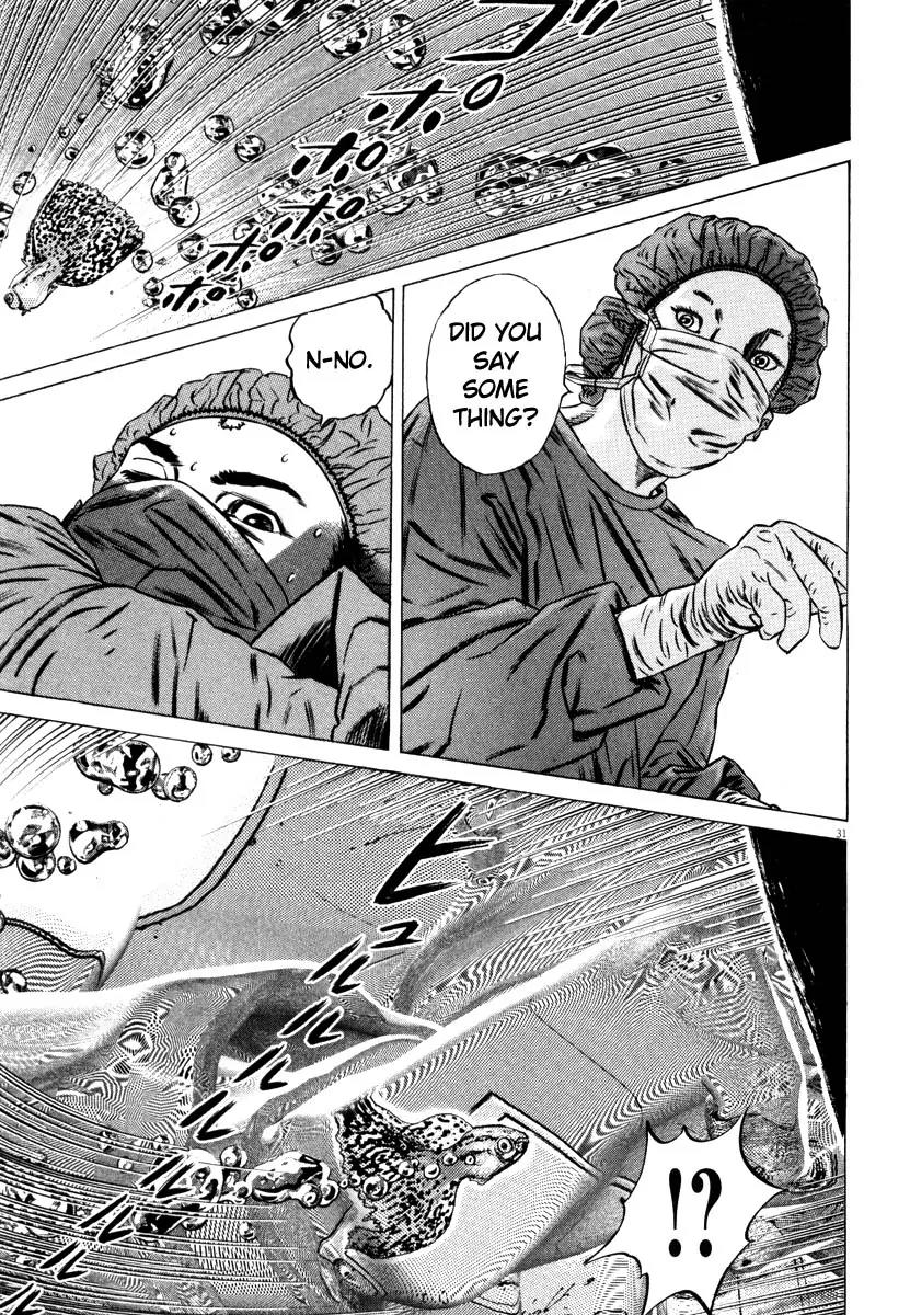 Homunculus Chapter 8.1 page 34 - Vol.8 Chapter 1