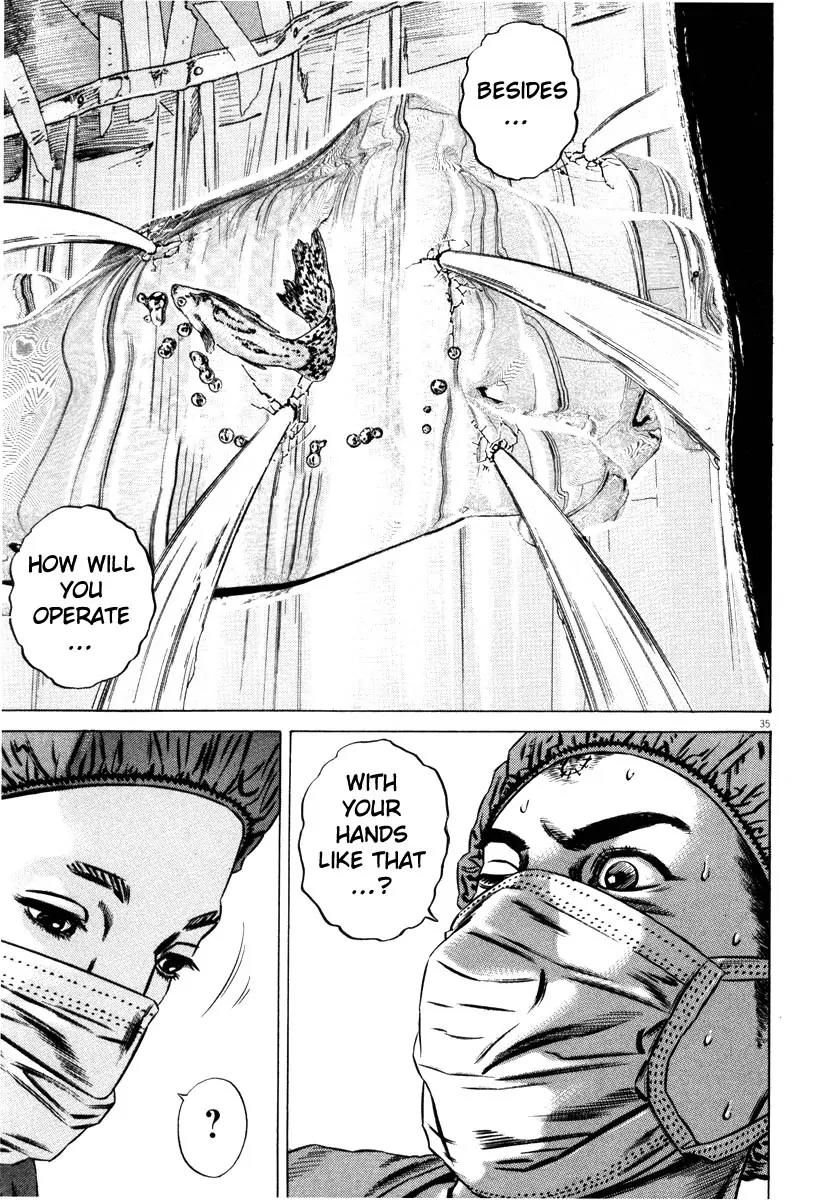 Homunculus Chapter 8.1 page 38 - Vol.8 Chapter 1