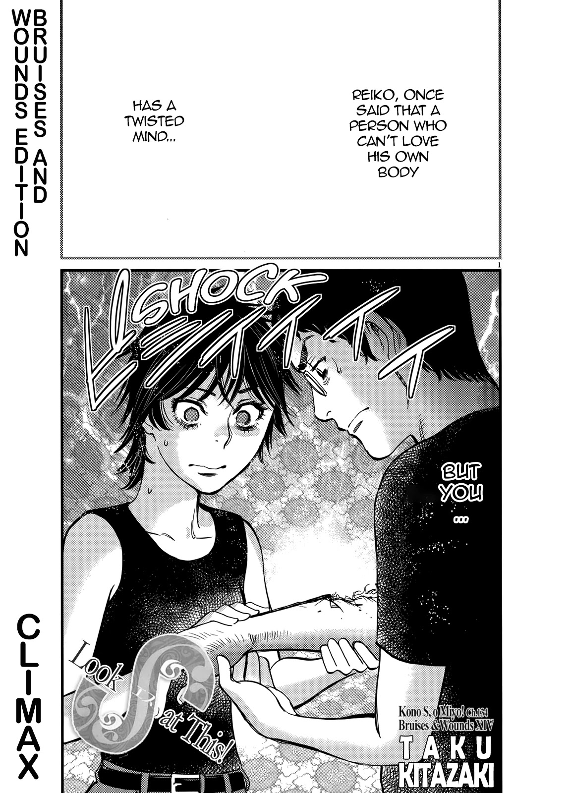 Kono S o, Mi yo! Chapter 134 page 1 - Chapter 134: Bruises and Wounds XIV