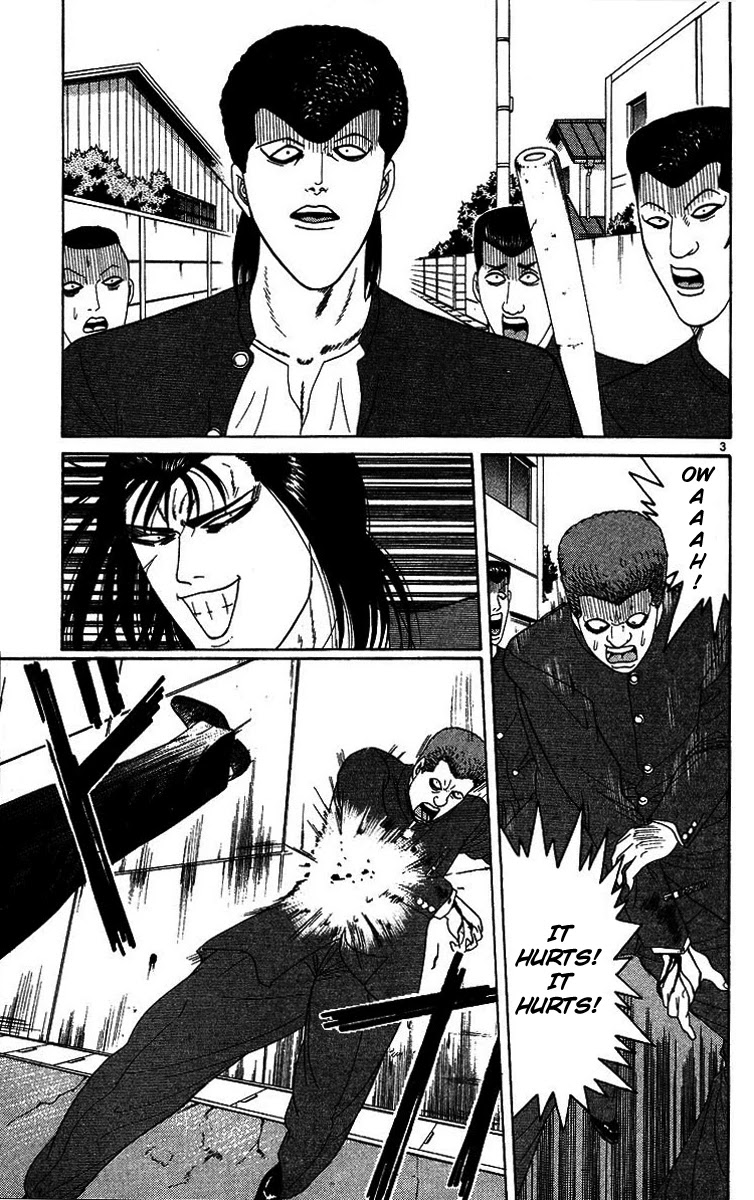 Kyou kara Ore wa!! Chapter 204 page 3 - Chapter 204: Under the Knife