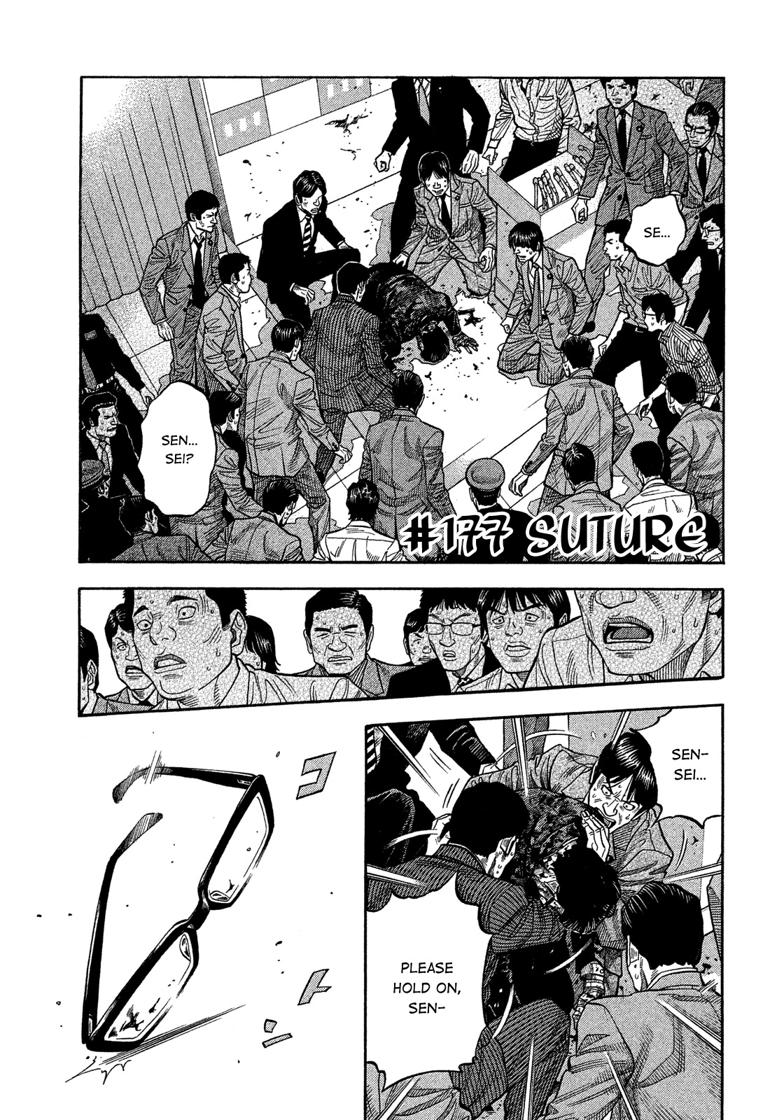 Montage (WATANABE Jun) Chapter 177 page 1 - Chapter 177: Suture