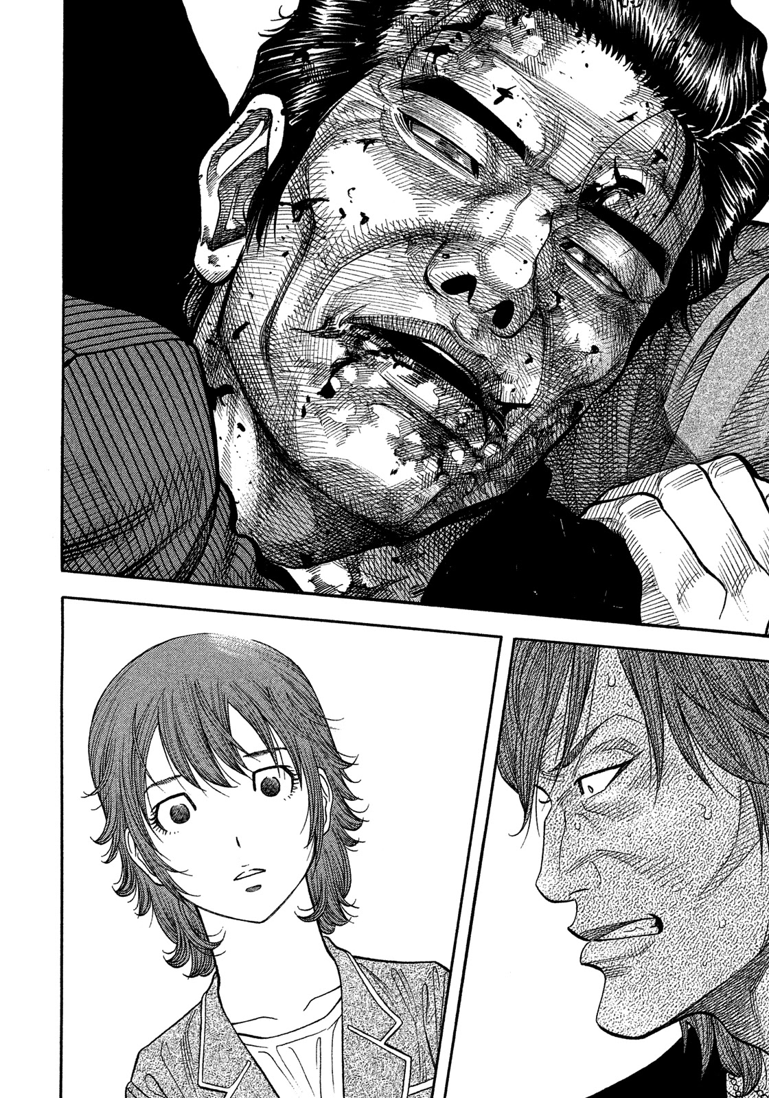 Montage (WATANABE Jun) Chapter 177 page 2 - Chapter 177: Suture
