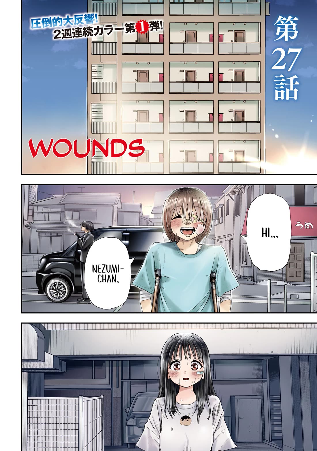 Nezumi's First Love Chapter 27 page 2 - Chapter 27: Wounds.