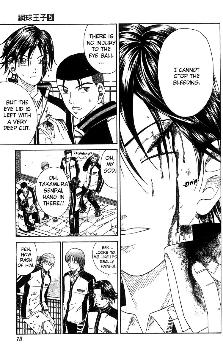 Prince of Tennis Chapter 38 page 5 - Chapter 38: The Decisive Battle