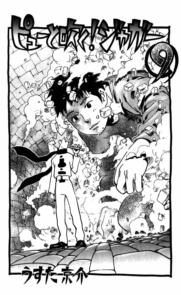 Pyu to Fuku! Jaguar Chapter 171 page 4 - Chapter 171: Popped Collar Hospitalized Patient