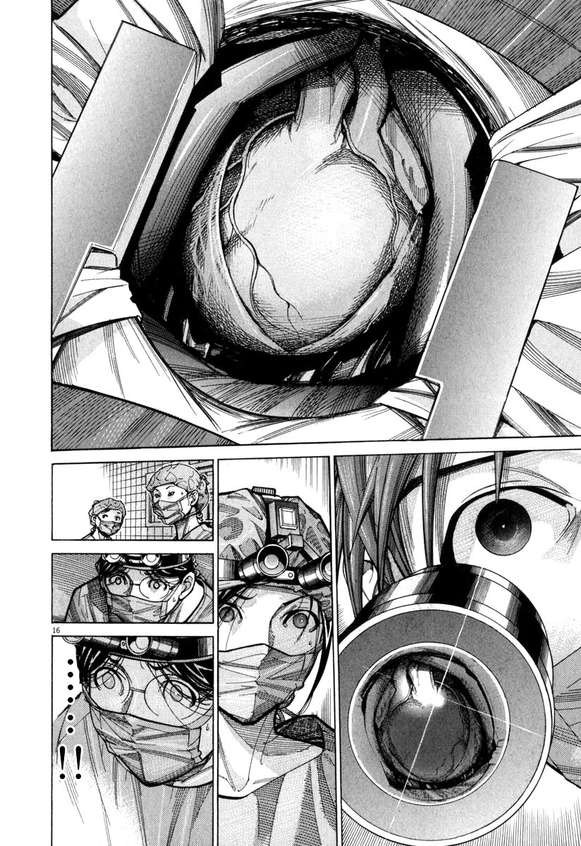 Team Medical Dragon Chapter 73 page 17 - Chapter 73: The 3rd Batista Procedure