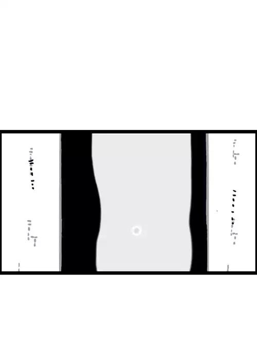 The Sound of Your Heart Chapter 381 page 40 - Chapter 381: Constipation